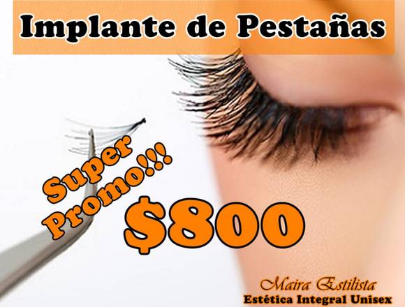Implante de Pestañas en Montevideo (Localidad)