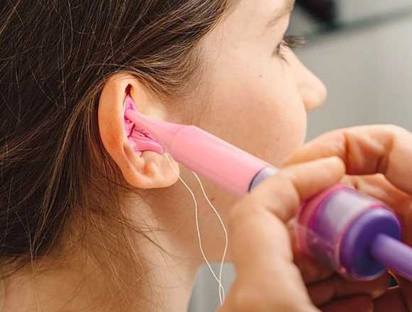 PROTECTORES AUDITIVOS HECHOS A LA MEDIDA