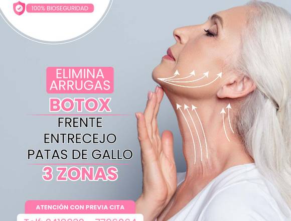 Elimina arrugas con botox en Miraflores (Distrito)