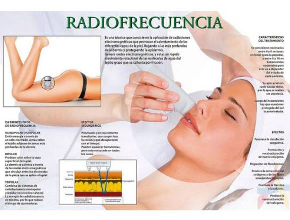 Radiofrecuencia facial en Salón Carolina’s en Quilmes (Localidad)