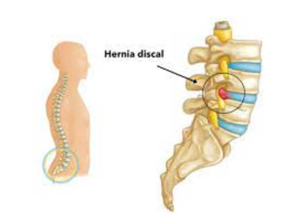 Consultorio Quiropractico & Terapia Integral en Cuenca (Cantón)