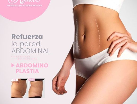 Luce un abdomen perfecto - Clínica Renacer en Lima (Lima 1) (Distrito)
