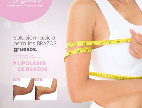 Mejora el aspecto de tus brazos - Clínica Renacer en Lima (Lima 1) (Distrito)