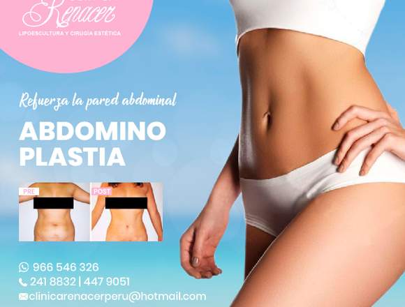 Recupera la firmeza abdominal - Clínica Renacer en Lima (Lima 1) (Distrito)