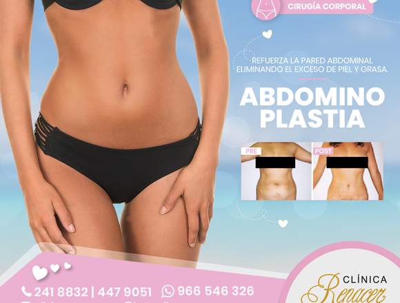 Refuerza la pared abdominal - Clínica Renacer en Miraflores (Lima 18) (Distrito)