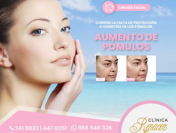 Pómulos mejor acentuados - Clínica Renacer en Miraflores (Lima 18) (Distrito)