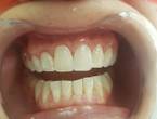 Unidad Estética Dental ODONTOFLEXY