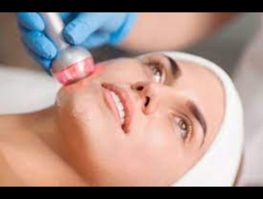 Tratamiento radiofrecuencia en Quilmes (Localidad)