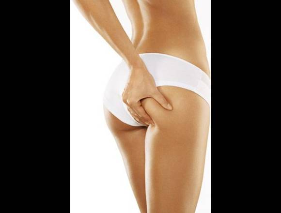Vela Slim en salon carolina´s en Quilmes Oeste (Localidad)
