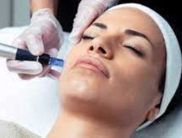reflejos y dermapen en salon carolina's en Quilmes (Localidad)