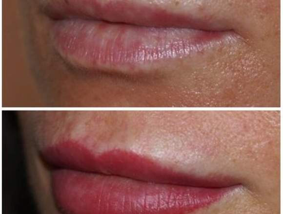 DELINEADO PERMANENTE SIN DOLOR OJOS, LABIOS, CEJAS en Naucalpan de Juárez (Municipio)