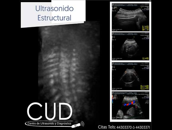 CUD Centro de ultrasonidos y Diagnósticos