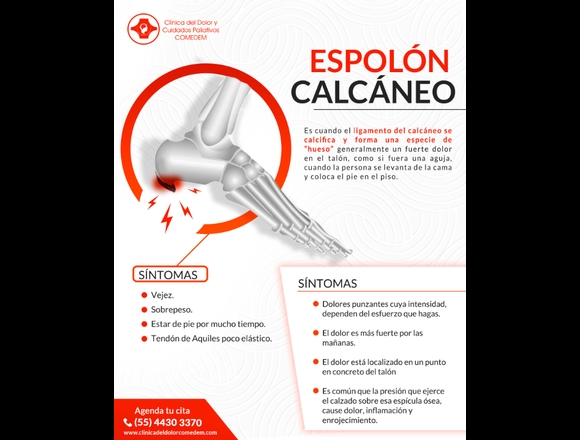 No más dolor al pisar