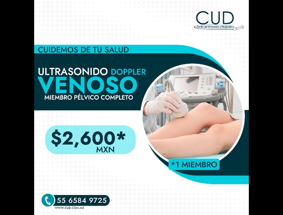 Ultrasonido doppler venoso miembro pélvico