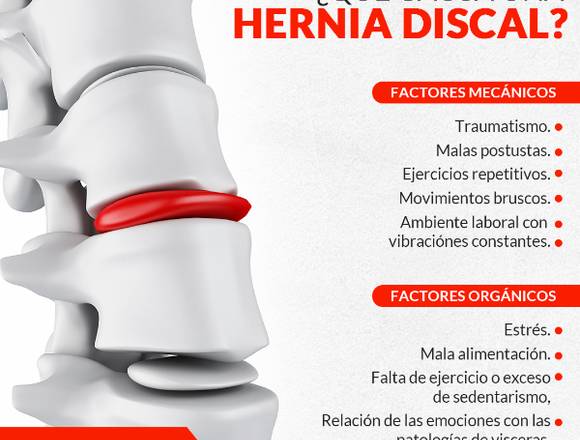 No vivas con hernia discal en Cuauhtémoc (Municipio)