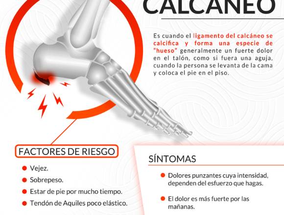 Espolón calcáneo, que es: