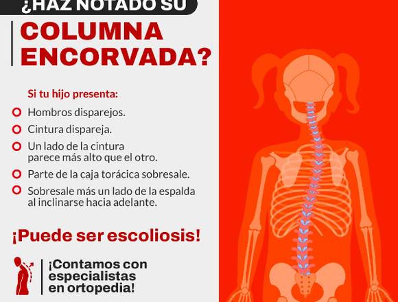 ¿Haz notado tu columna encorvada? en Cuauhtémoc (Municipio)