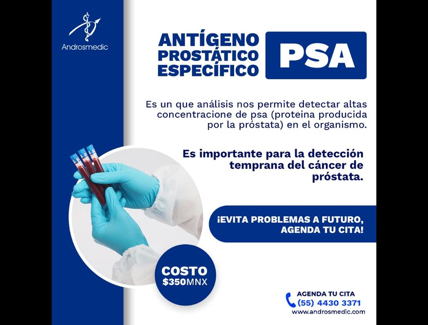 El PSA es una herramienta esencial