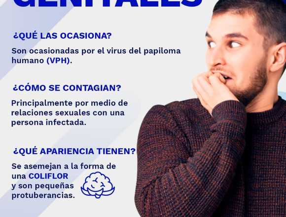 Las verrugas genitales son muy comunes en Querétaro (Municipio)