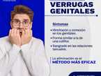La verrugas genitales