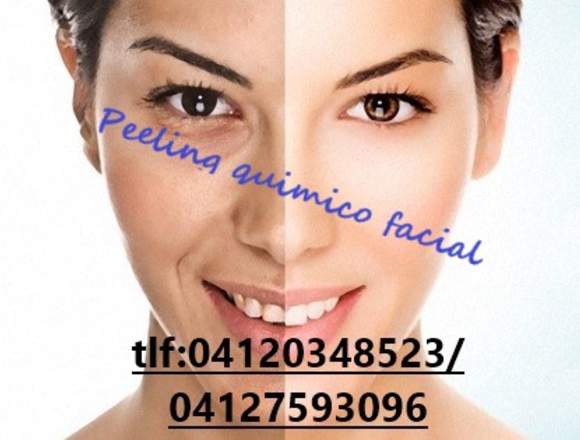 Peeling Químico Facial en Libertador (Municipio)