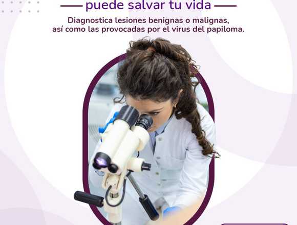 La COLPOSCOPÍA puede salvar tu vida en Cuauhtémoc (Municipio)