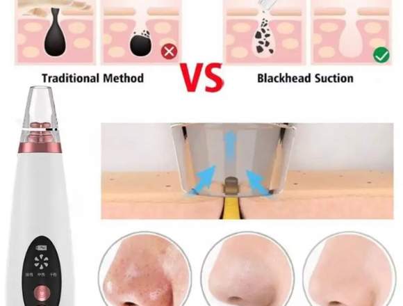 Máquina de limpieza Facial de poros en Veracruz (Municipio)