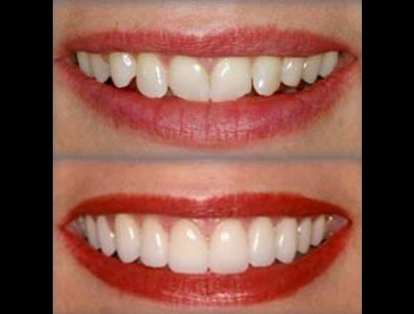 odontología restauradora y estética
