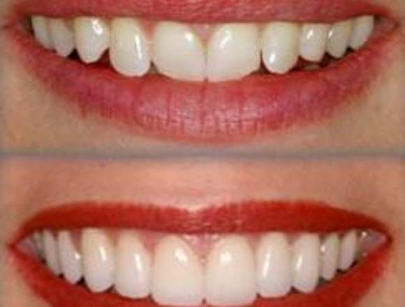 odontología restauradora y estética