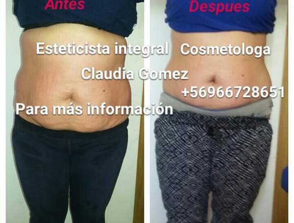 masajes reductivos, yesoterapia en Santiago (Comuna)