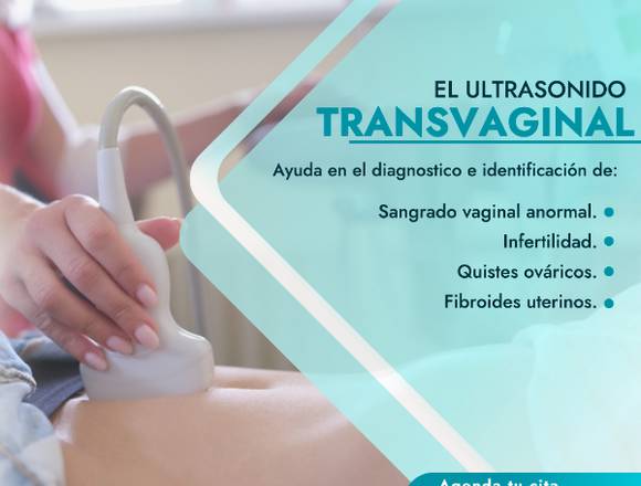 Ultrasonido TRANSVAGINAL en Cuauhtémoc (Municipio)