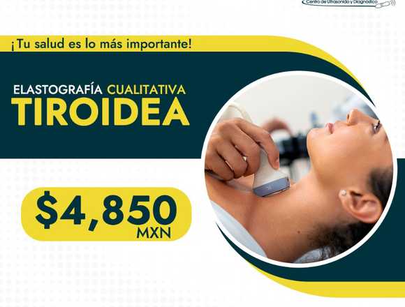 ELASTOGRAFÍA cualitativa TIROIDEA en Cuauhtémoc (Municipio)