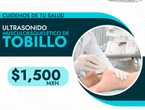 ¿Problemas en tu tobillo? en Cuauhtémoc (Municipio)