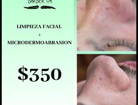 Limpieza facial mas microdermoabrasion