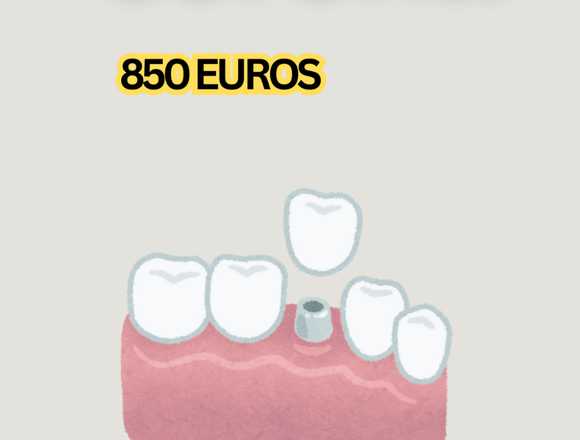 PROMOCIÓN IMPLANTE+CORONA en Barcelona (Municipio)
