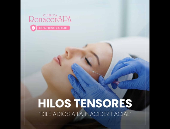 Hilos faciales - medicina estetica en San Luis (Lima 30) (Distrito)