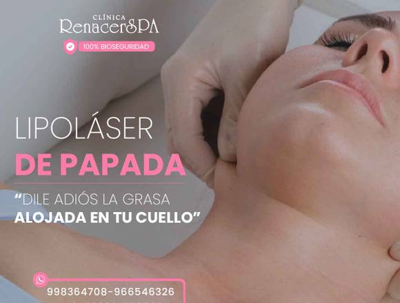 Lipopapada - cirugia en San Luis (Lima 30) (Distrito)