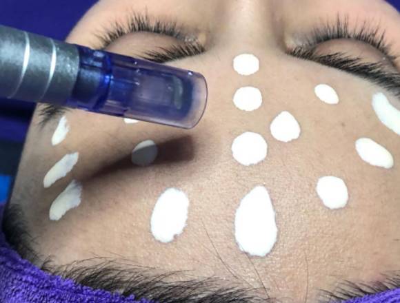 LIMPIEZA DE CUTIS EN LA SESION DE COSMIATRIA en Buenos Aires (Localidad)