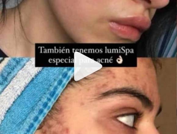 Espectacular Galvanic Facial en Santiago de Cali (Municipio)