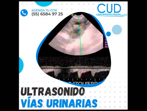 ULTRASONIDO VÍAS URINARIAS