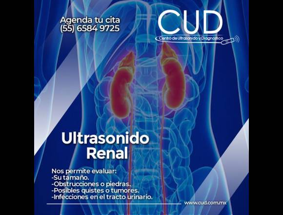¿POR QUÉ SE REALIZA UN ULTRASONIDO RENAL?