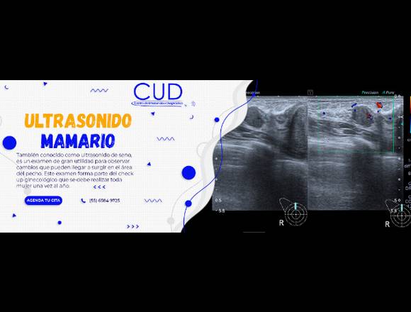 ULTRASONIDO MAMARIO