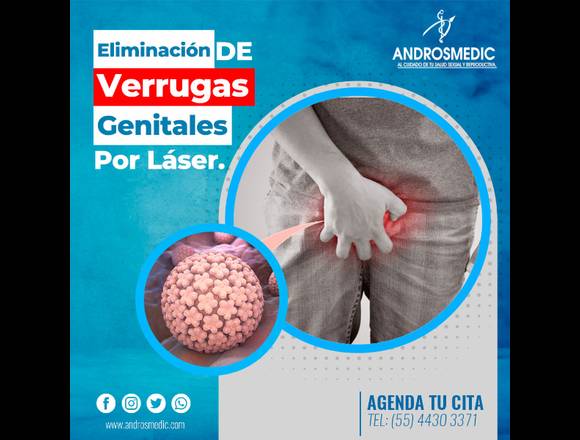 Eliminación de Verrugas Genitales