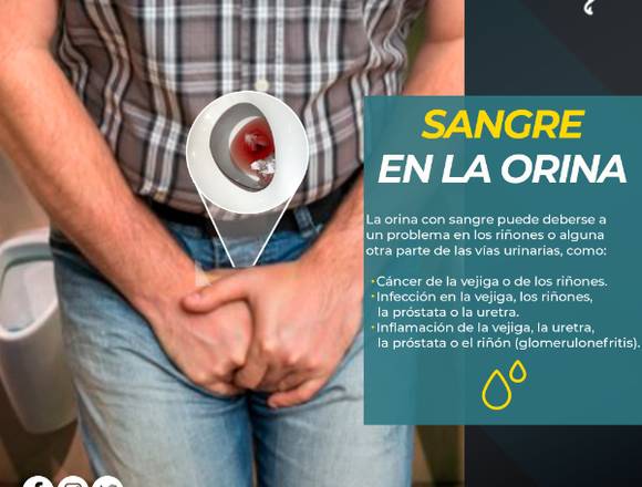 🍆 Sangre en la Orina 🩸 en Cuauhtémoc (Municipio)