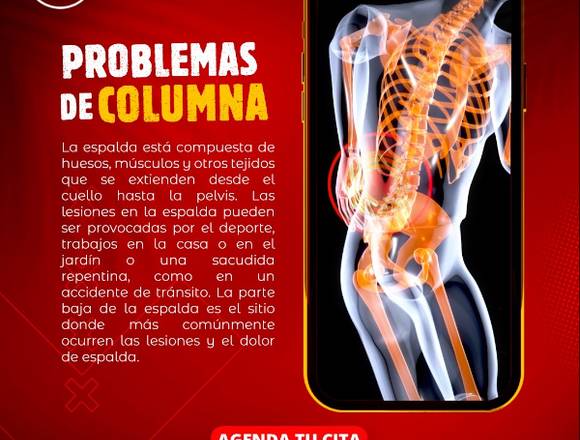 Problemas de Columna .-..--...- en Cuauhtémoc (Municipio)