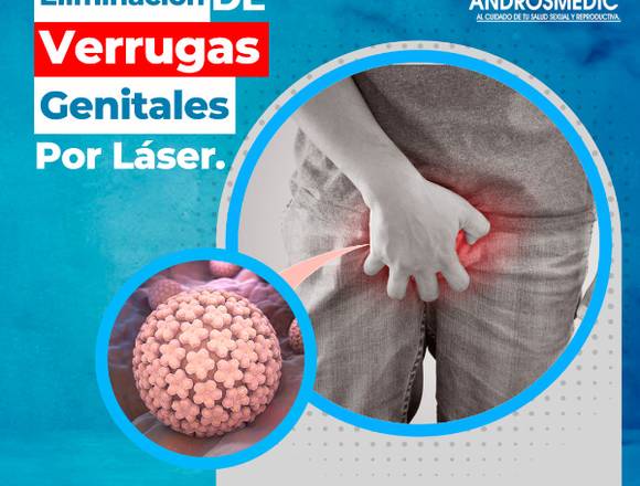 Eliminación de Verrugas Genitales