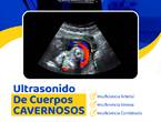 Ultrasonido de Cuerpos Cavernosos ....-..-.