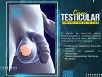 🥵 Cáncer Testícular 🥚🥚