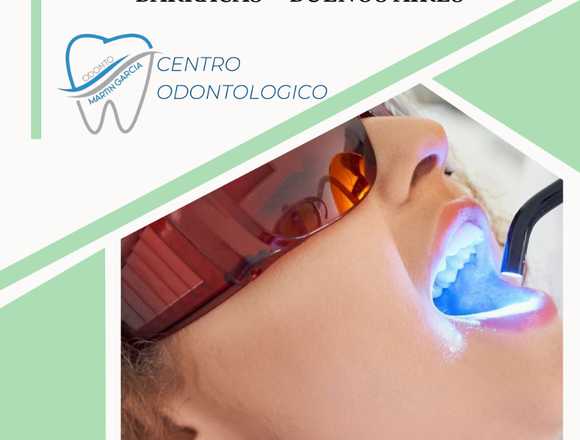 Blanqueamiento dental/ Odonto Martín Garcia en Buenos Aires (Localidad)