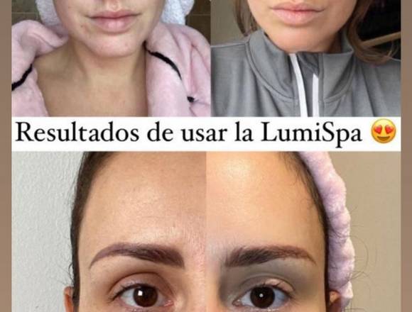 lumispa dermolimpiadora en Bogotá, D.C. (Municipio)